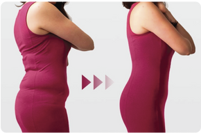Wearing Daily Shapewear After Gastric Bypass